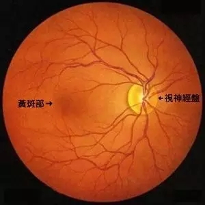 吸烟会增加患老年性黄斑变性的风险吗？