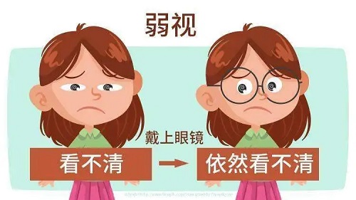 什么是弱视？