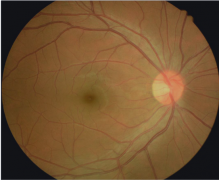 【健康科普】9个常见眼科小知识，值得收藏